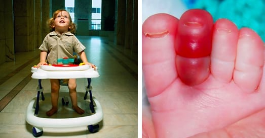 baby walker injuries